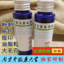 中藥祛痘產(chǎn)品前五強(qiáng) 科學(xué)祛痘，收細(xì)毛孔，告別粉刺痤瘡